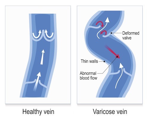 function of venous valves